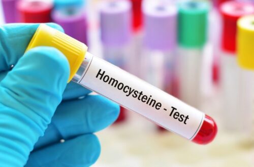 Homocysteina – co powinieneś o niej wiedzieć